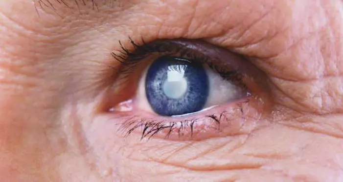 40 por cento dos diabéticos  desenvolvem retinopatia